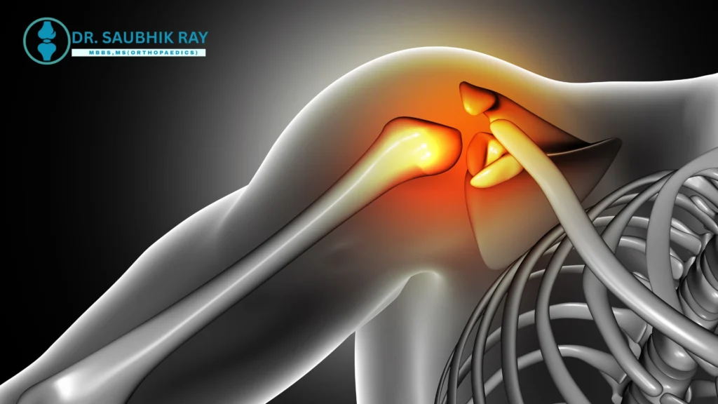 shoulder pain treatment in Kolkata
