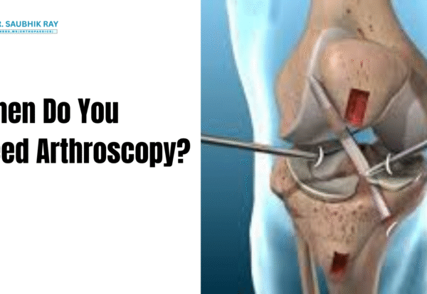 Orthopaedic Surgeon in Kolkata