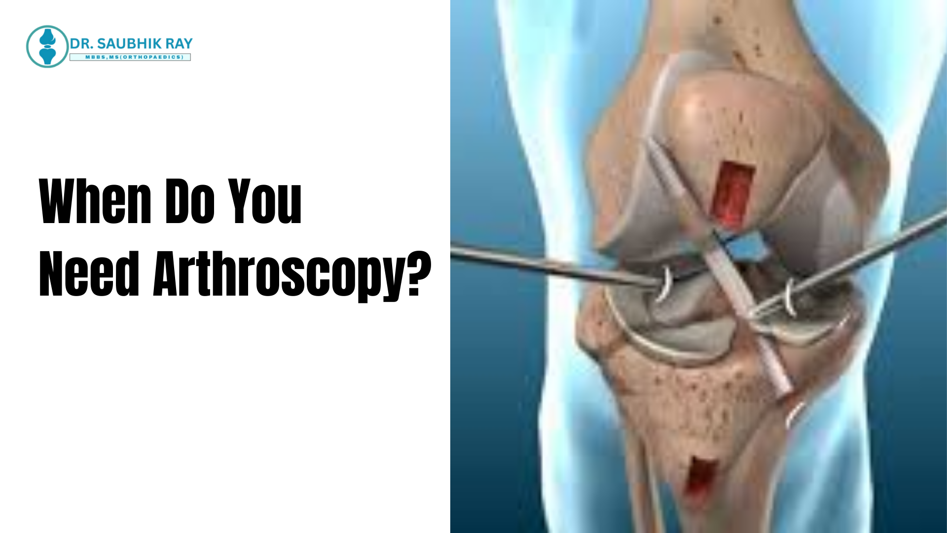 Orthopaedic Surgeon in Kolkata