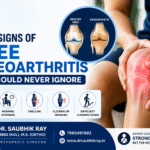 Early Signs of Knee Osteoarthritis You Should Never Ignore