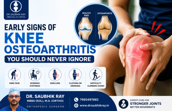Early Signs of Knee Osteoarthritis You Should Never Ignore Early Signs of Knee Osteoarthritis You Should Never Ignore