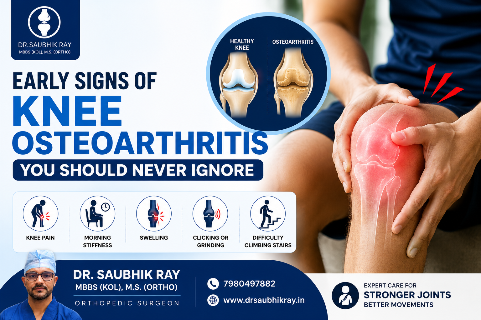 Early Signs of Knee Osteoarthritis You Should Never Ignore